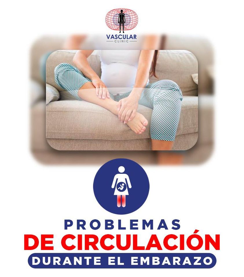 Problemas de circulación durante el embarazo