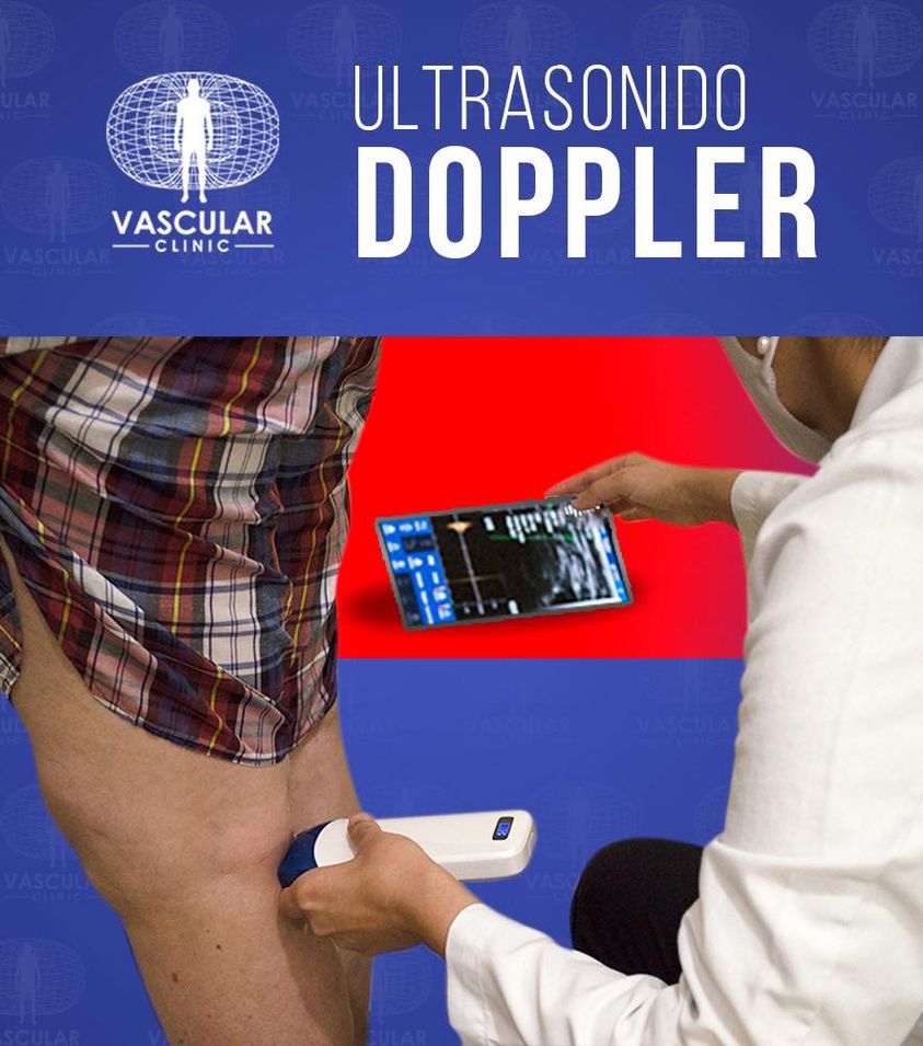 Ultrasonido Doppler